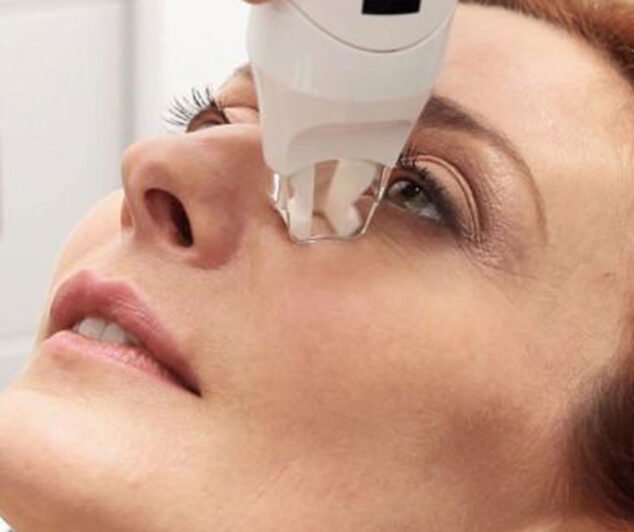 Image: Treatment of the eye contour in Dénia with LPG Endermologie at Center Fisiobioestètic
