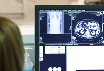 Radiografía en el Hospital de Dénia