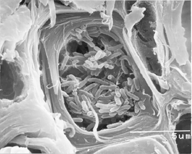 Imagen: Fotografía de Xylella fastidiosa al microscopio electrónico de barrido