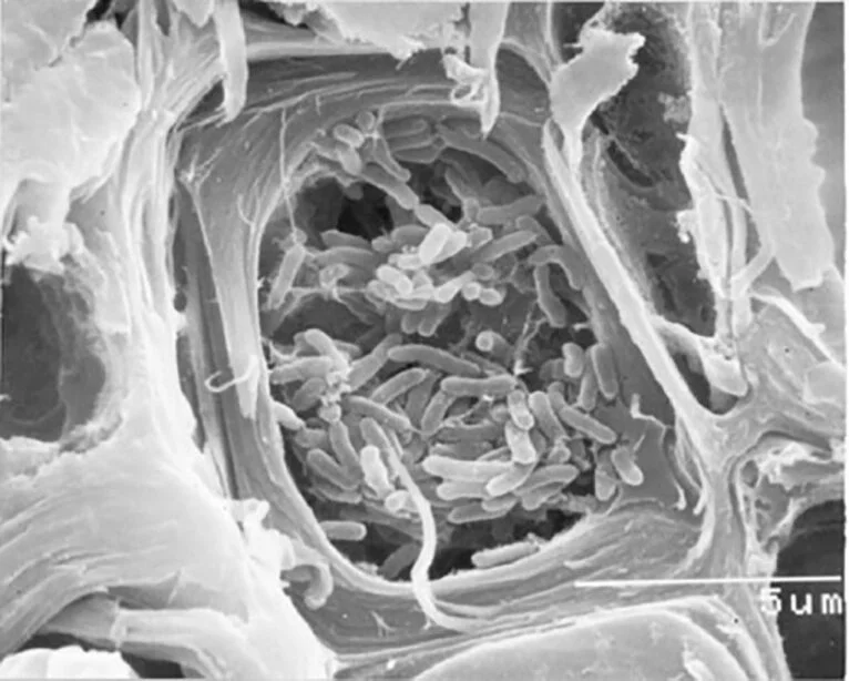 Fotografía de Xylella fastidiosa al microscopio electrónico de barrido