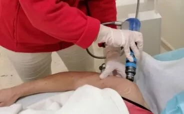 nueva terapia ondas choque rema rehabilitacion marina alta fb