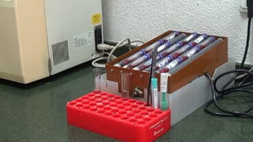 Análisis de sangre en Dénia – Laboratorios González