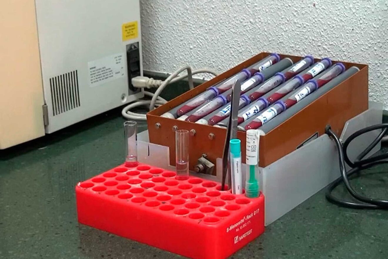 Analisis de samgre en Denia - Laboratorios Gonzalez