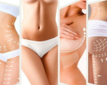 BellActio Duo en Centro de estética Guaraná