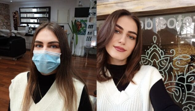 Imagen: Antes y después del tratamiento de Yoanka Gallardo