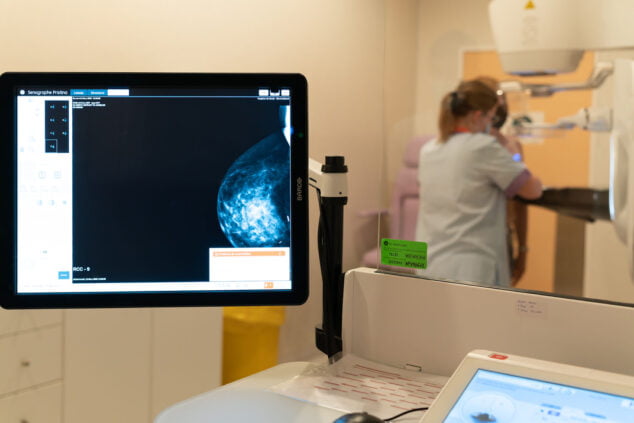 Imagen: Nuevo mamógrafo 3D del hospital de Dénia