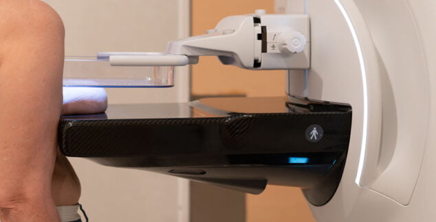 Imagen: Prueba con el nuevo mamógrafo 3D del hospital