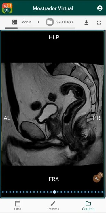 Comprueba los resultados de tus radiografías