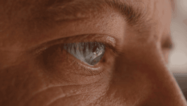 envejecimiento de la piel policlinica cume