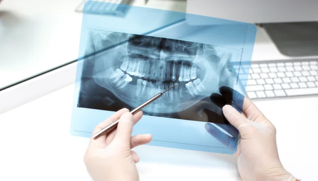 Imagen: Implantes dentales en Clínica Phi