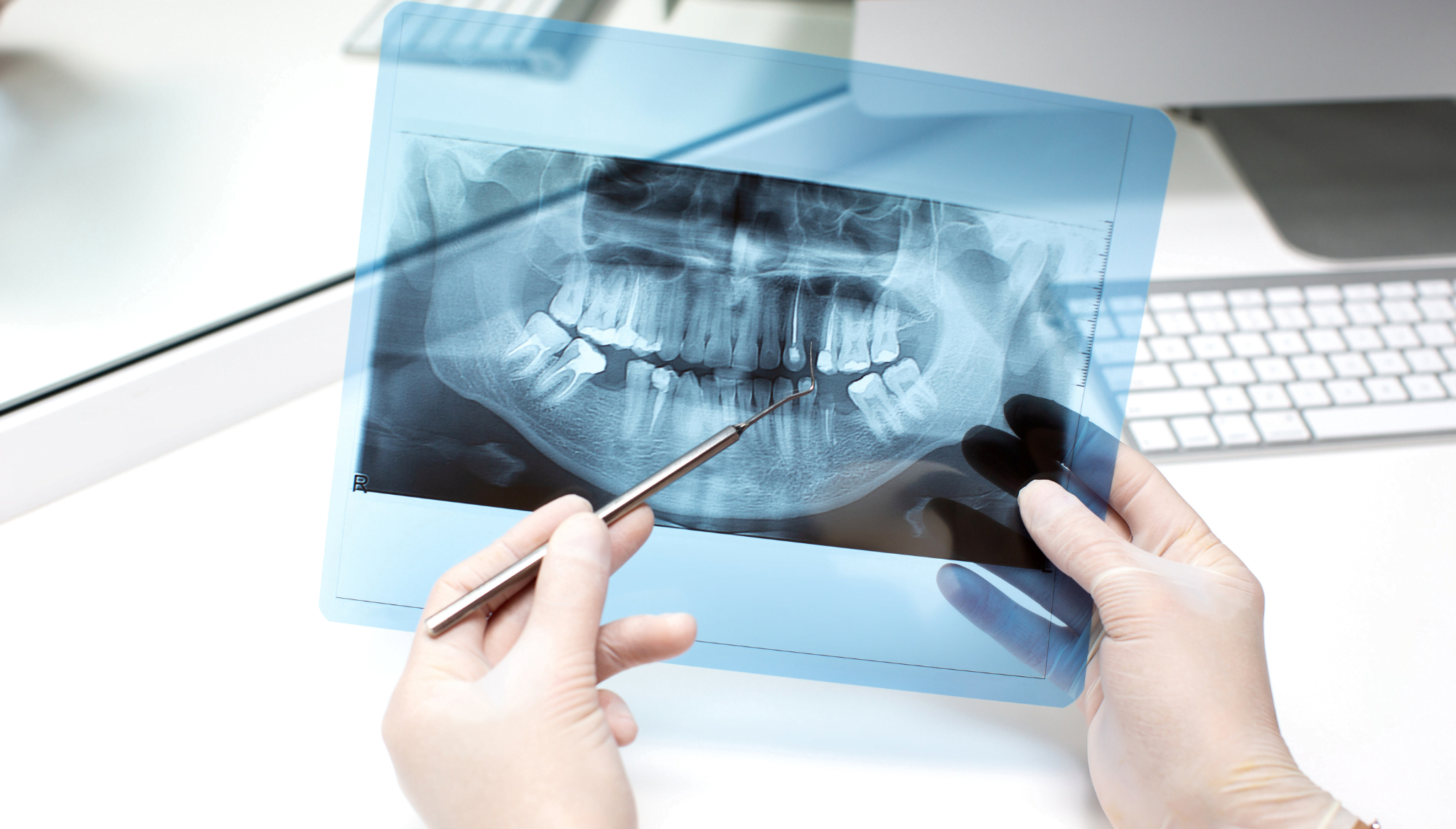 Implantes dentales en Clínica Phi