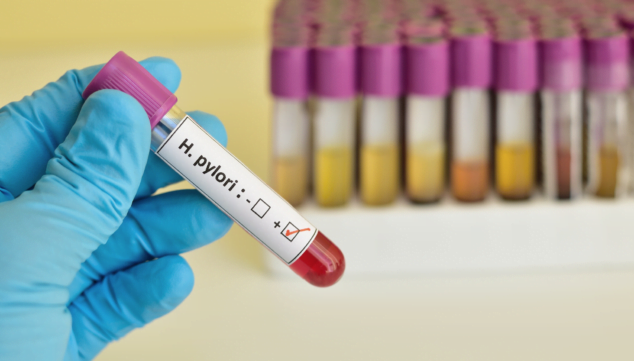 Imagen: En Laboratorios González hacen análisis de sangre para diagnosticar la H. Pylori