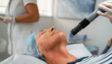 Consigue un efecto lifting con Morpheus 8 en Castelblanque