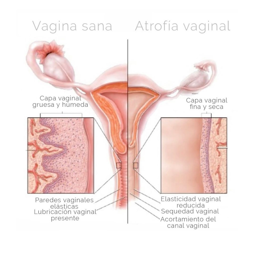 Salud Genital en Clínica Doctora Flores de Apodaca