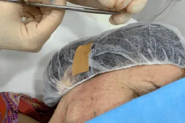 Conoce las principales ventajas de los hilos tensores