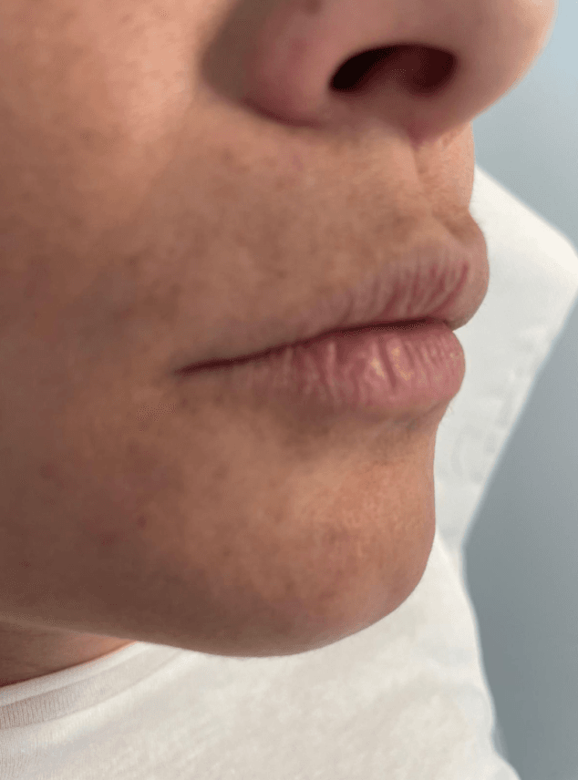 si tienes labios deshidratados descubre este gran tratamiento