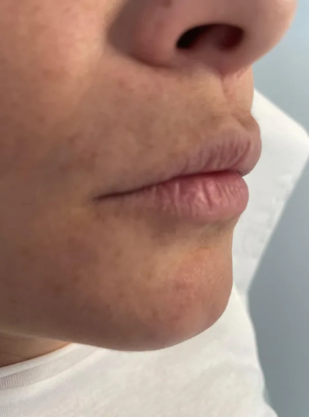 El tratamiento revolucionario con el que mantener tus labios hidratados y voluminosos 1 si tienes labios deshidratados descubre este gran tratamiento