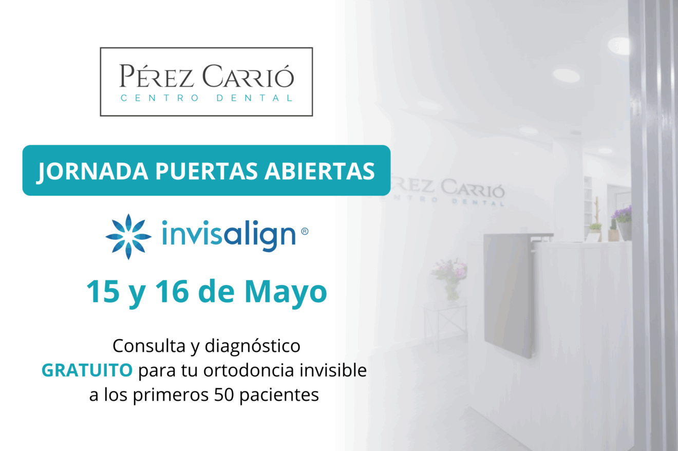 Consulta y diagnóstico gratuito en Centro Dental Pérez Carrió