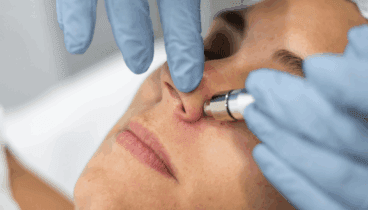 Estos tratamientos te ayudarán a mantener una piel firme