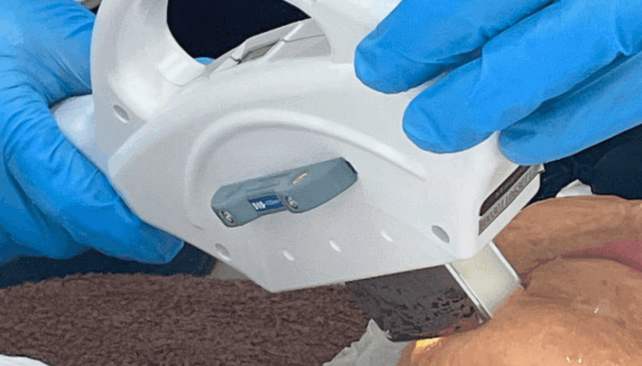 Piel luminosa y libre de imperfecciones con este método de depilación avanzada