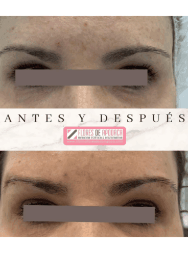 Elevación de cejas con Hilos Tensores Rainbow Thread