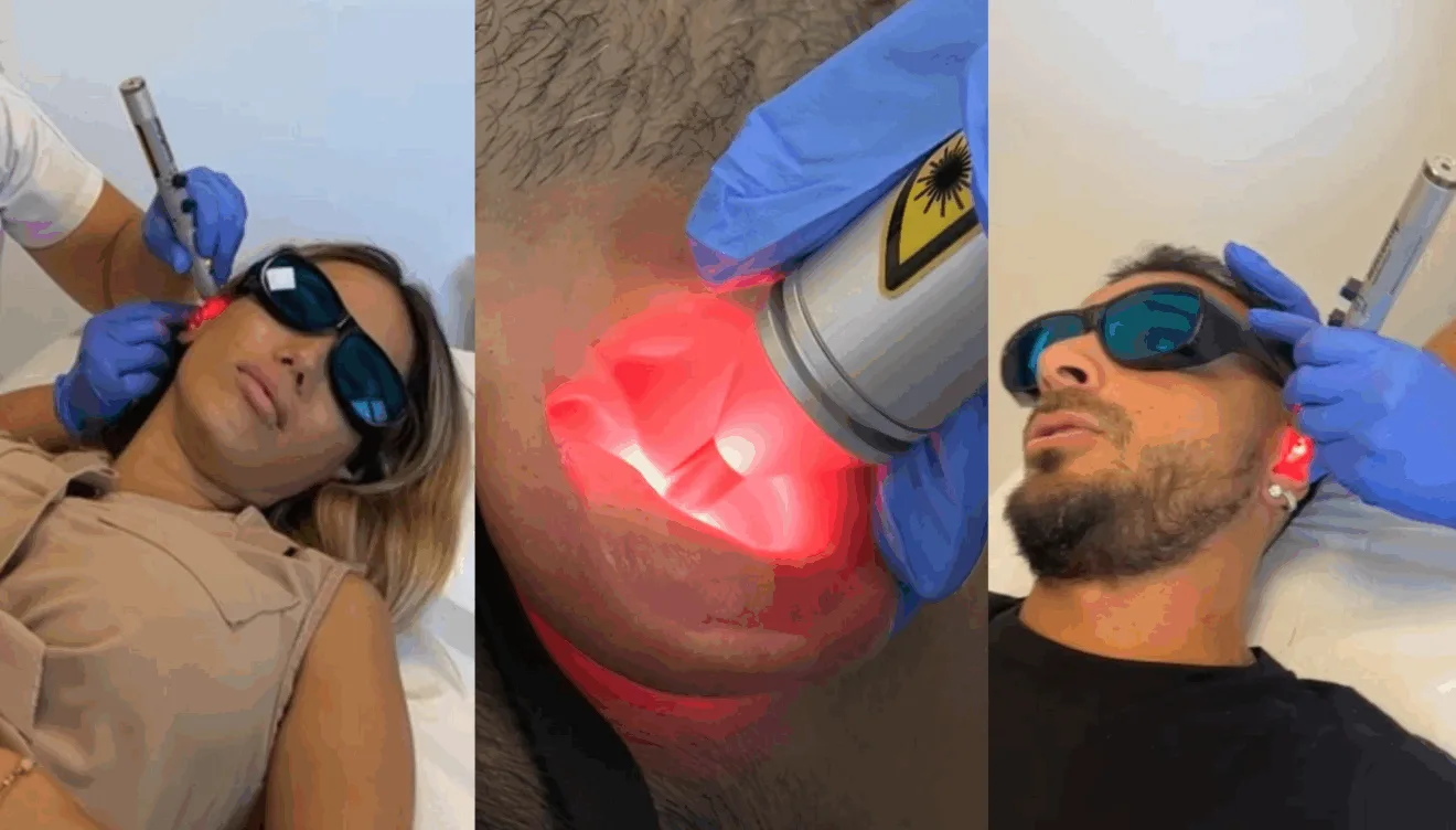El método laserOstop se basa en la fotobiomodulación láser para dejar de fumar
