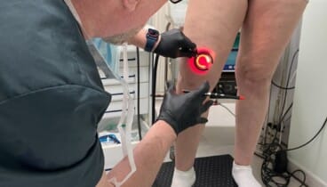 De la esclerosis a la microcirugía: la guía definitiva para borrar tus varices 57 procedimiento de microcirugia ambulatoria para eliminar venas dilatadas