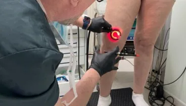 procedimiento de microcirugia ambulatoria para eliminar venas dilatadas