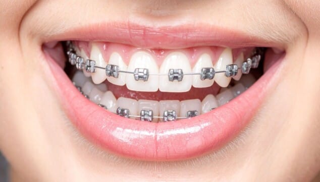 Imagen: Respirar por la nariz permite que la boca crezca correctamente, que los dientes se coloquen bien y que el cuerpo mantenga una buena postura