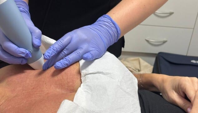 La medicina regenerativa da un paso más: la tecnología que transformará tu rostro antes y durante el verano 10 Imagen: Consigue resultados sorprendentes con la tecnología 4 en 1 de Exion
