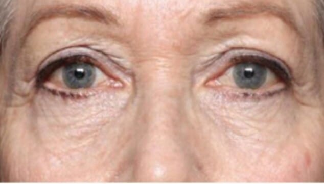 La medicina regenerativa da un paso más: la tecnología que transformará tu rostro antes y durante el verano 14 consigue todos los elementos perdidos y rehidrata tu piel con exion