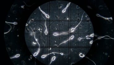 detalle de espermatozoides bajo la lente de un microscopio