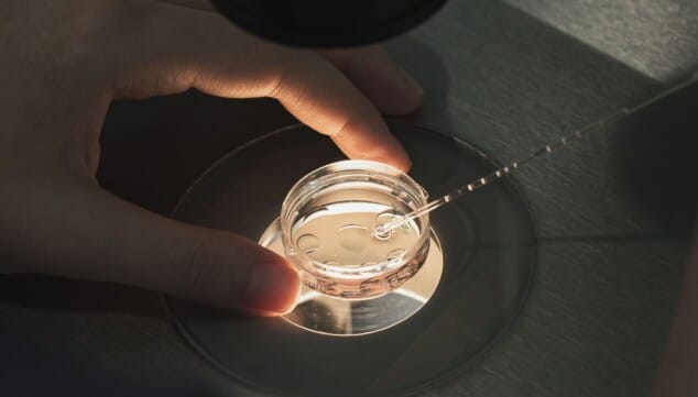 ¿Eres fértil?: la prueba que todo hombre debería hacerse antes de ser padre 6 Imagen: Muestra preparada para un análisis de fertilidad masculina