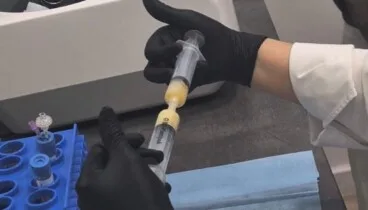 Obtención del plasma en Clínica Doctora Flores de Apodaca