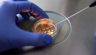 Tecnología avanzada para detectar anomalías