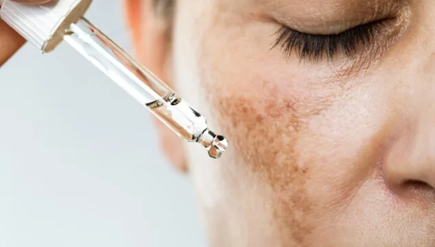 ¿Es buen momento para un peeling facial? Las opciones más seguras durante el verano 3 la combinacion con el sol provoca manchas solares profundas o quemaduras graves