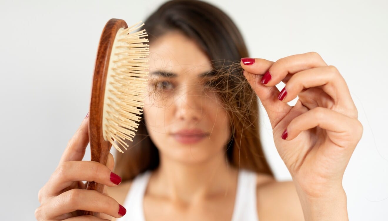 La pérdida de cabello genera una gran preocupación en miles de personas