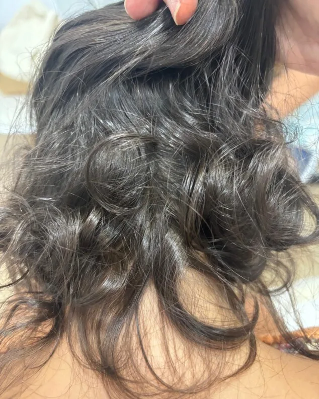 La clave para frenar la caída del cabello está en un diagnóstico personalizado 12 tras 1 ano de tratamiento la paciente recupero el cabello 1