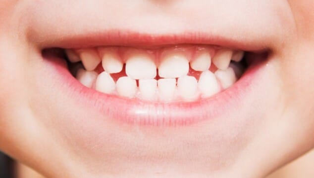 higiene bucodental infantil