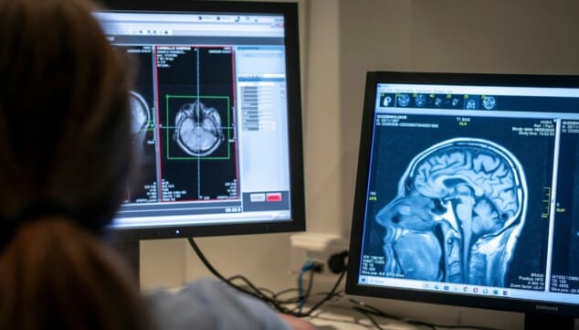 policlinica glorieta amplia su area de neuropsicologia